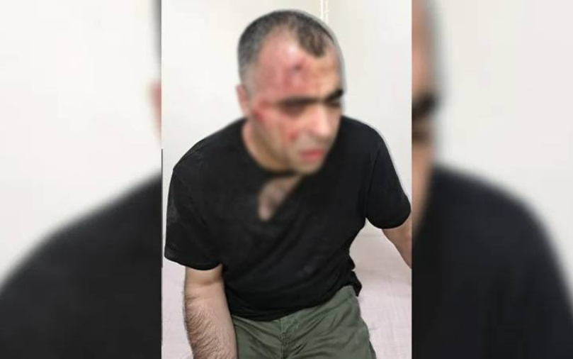 Gazeteci Sinan Aygül'e saldırı: Korumalar gözaltına alındı